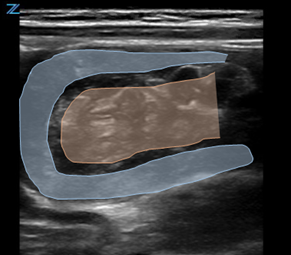 Mastering Image 2a.png