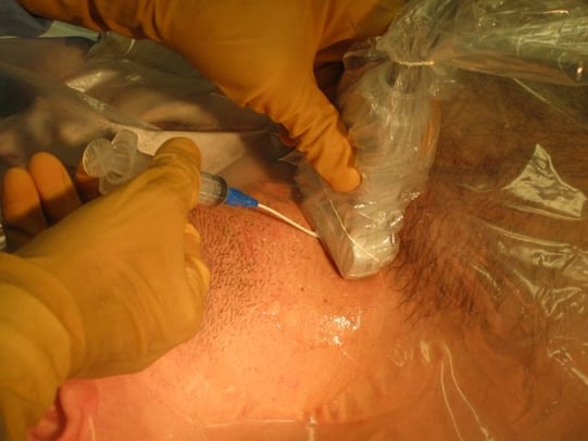 Figure 2. Sterile prep.jpg