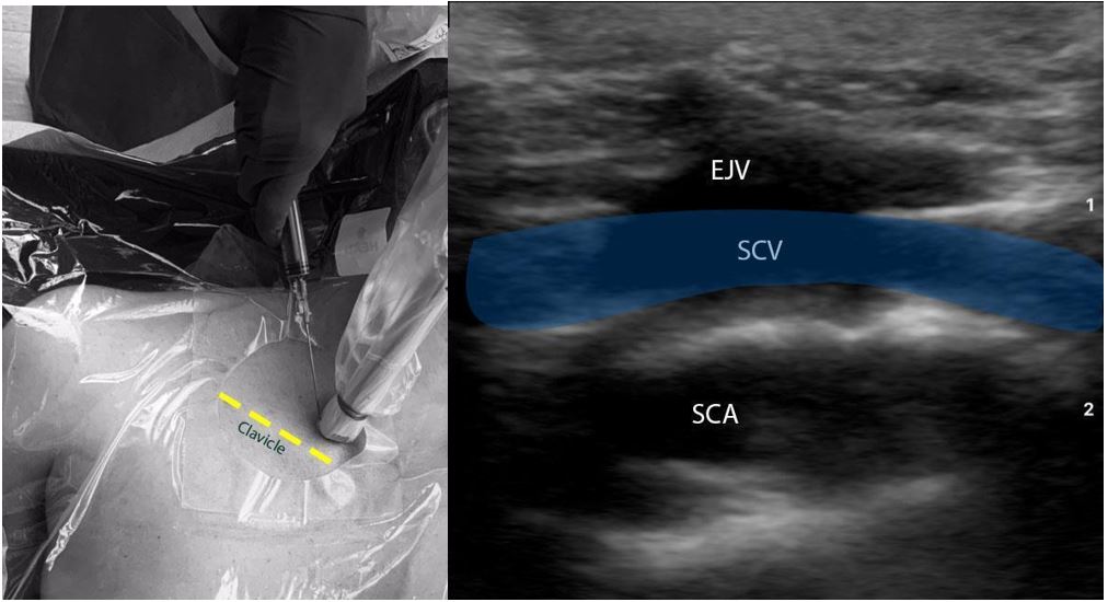 Tips and Tricks 3 REV.JPG