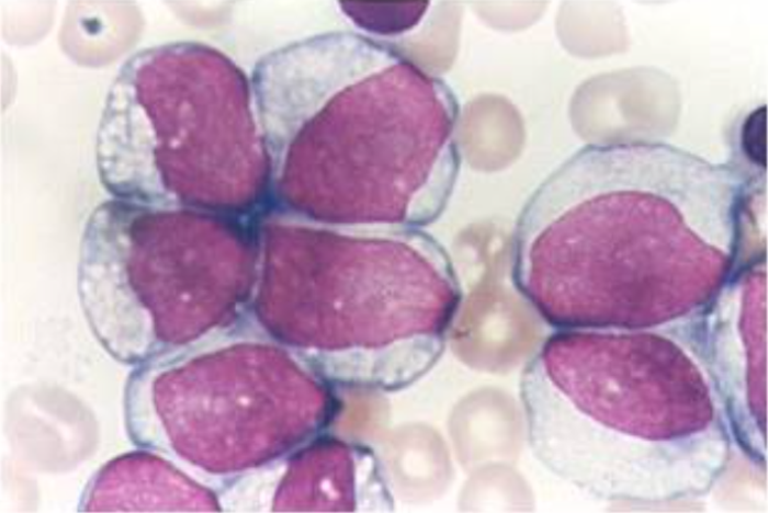 Hyperleuko-Jan 2025 (2).png