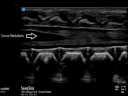 Pocus img4.jpg