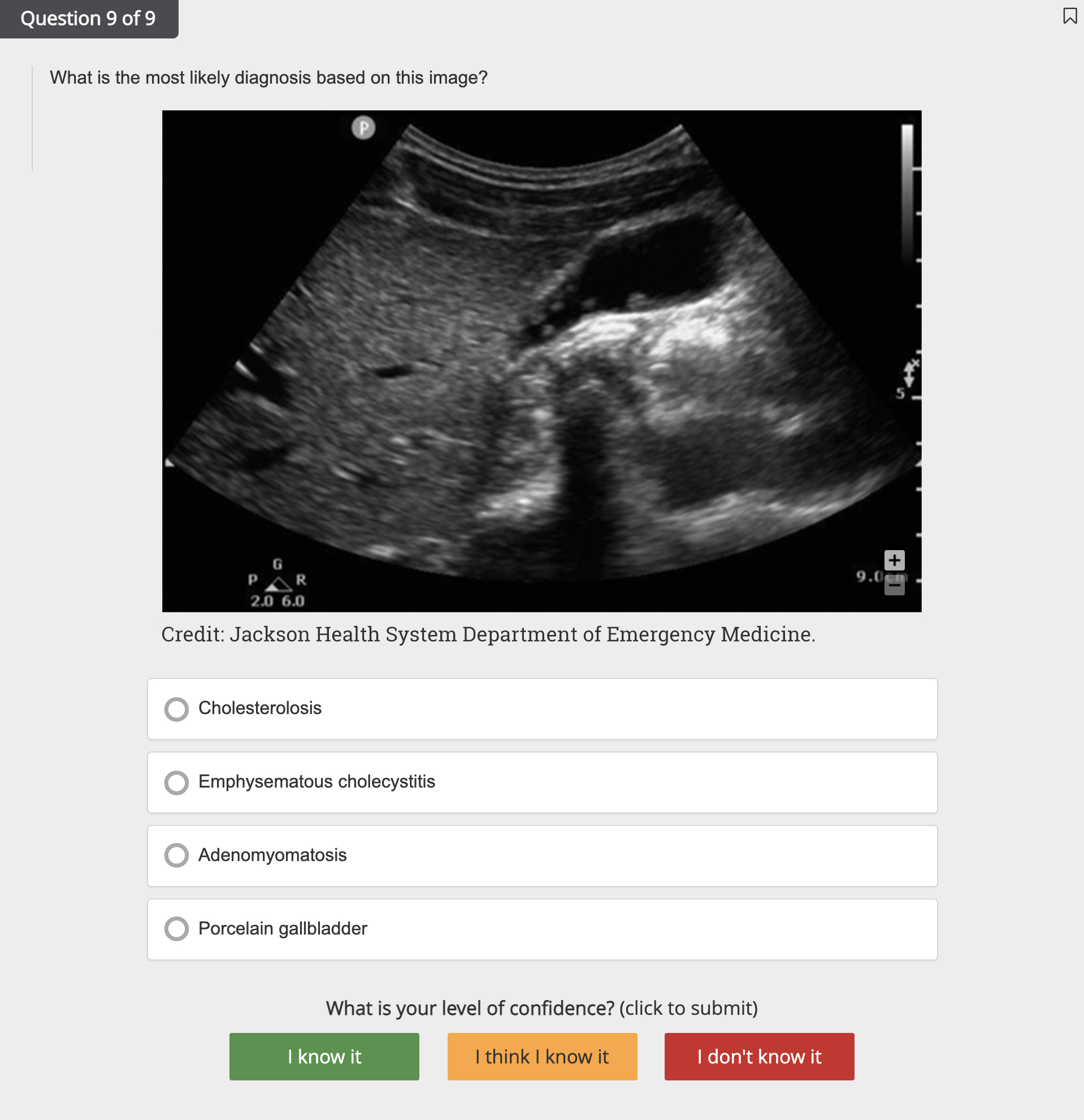 What is the most likely diagnosis based on this image?