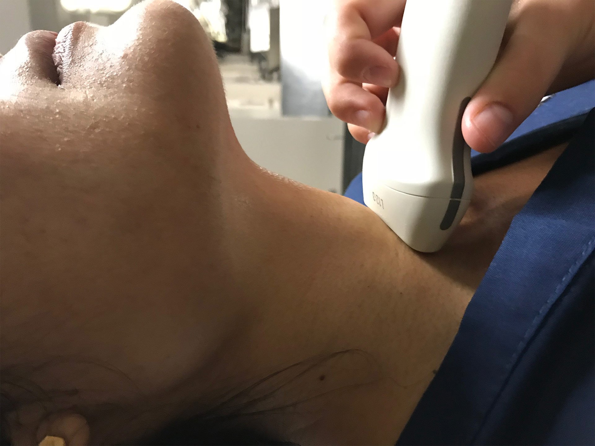 Figure 7b - Probe.jpg