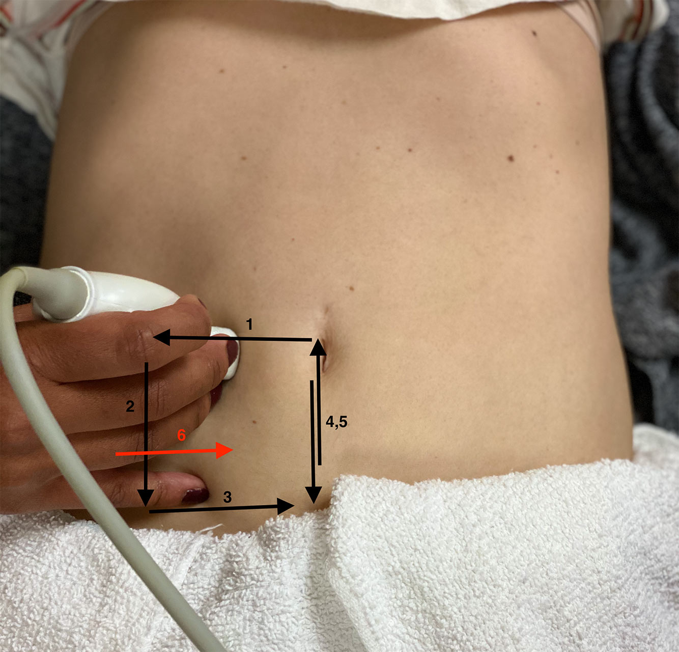 Figure 3 - Scan Protocol.jpg