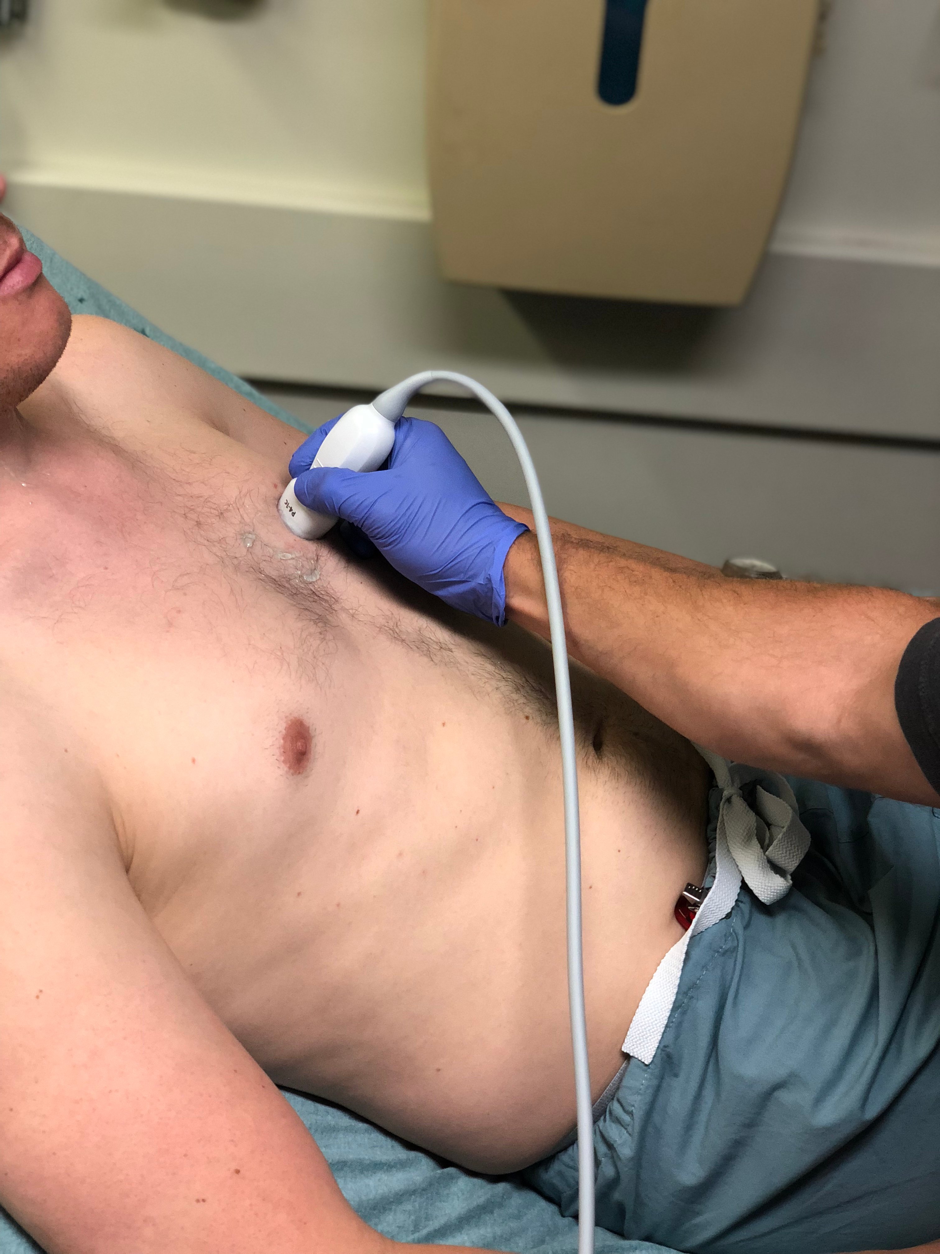 Image 9. Probe position for acquisition of parasternal short axis view.jpg