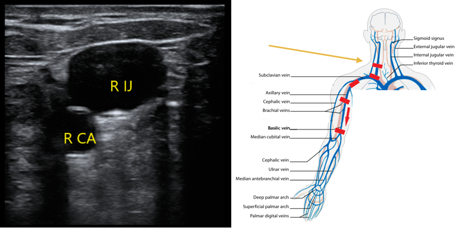 Figure 3 IJ scanning technique.png