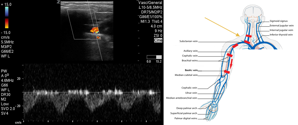 Figure 4 SC RSV scannig technique.png