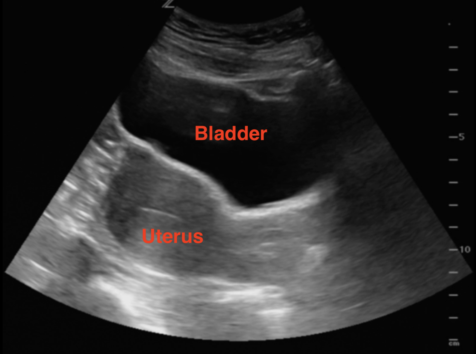 Illustration 4- Transverse view of pelvis .png