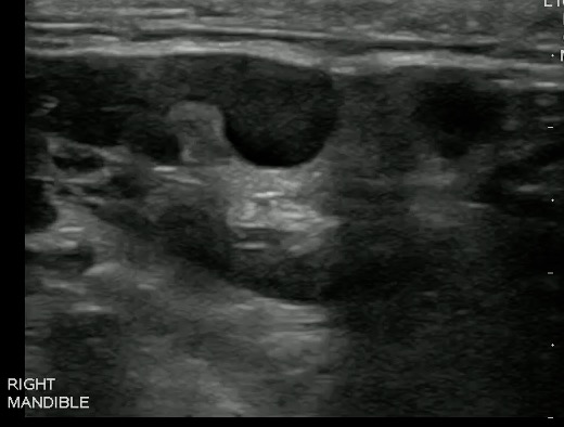 -Figure 11 - Lymph Node.jpg