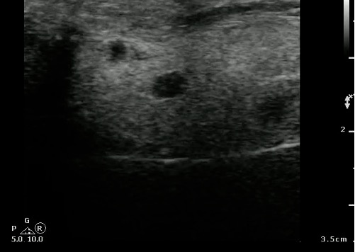 -Figure 19 - Parotid Lymph Nodes.jpg