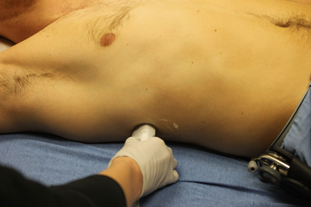 Figure 10 - Probe position for right sided pleural fluid evaluation.jpg