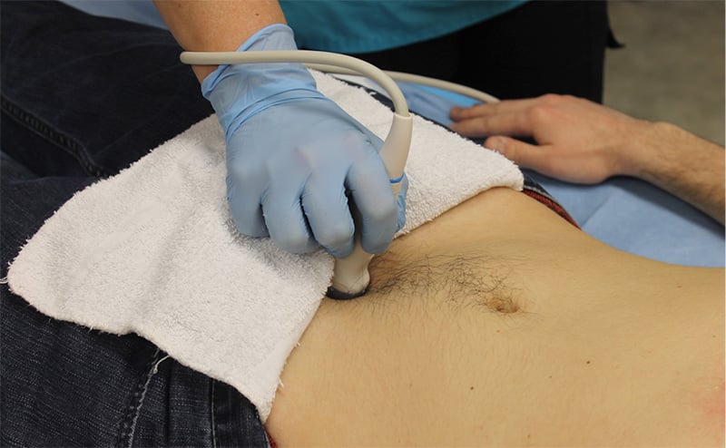 Figure 14 - Probe position for longitudinal view of the bladder.jpg