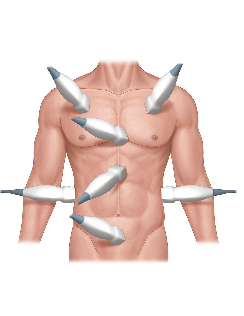 Ill 1_Overview of regions scanned in EFAST.jpg