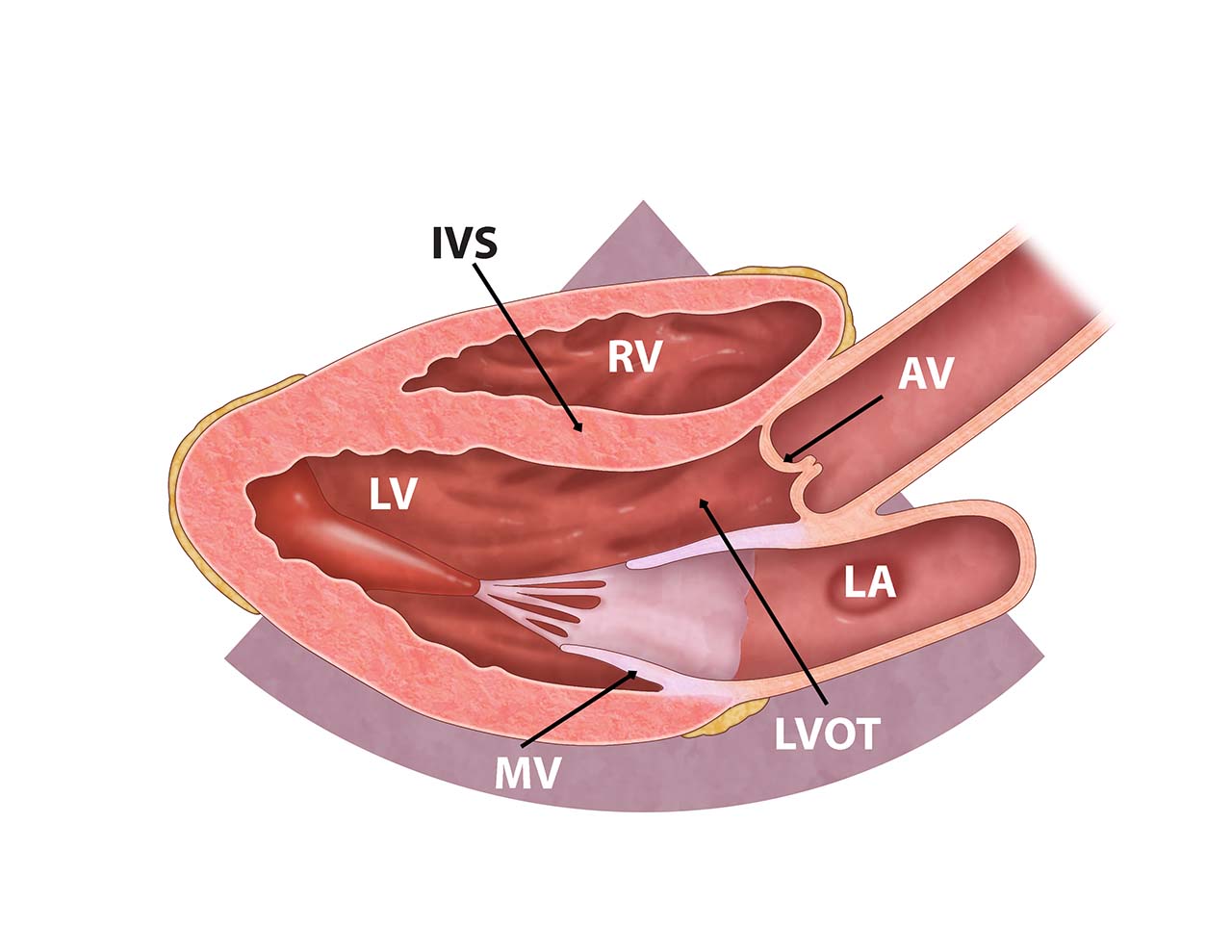 Ill 3_Cardiac anatomy from parasternal LA View.jpg