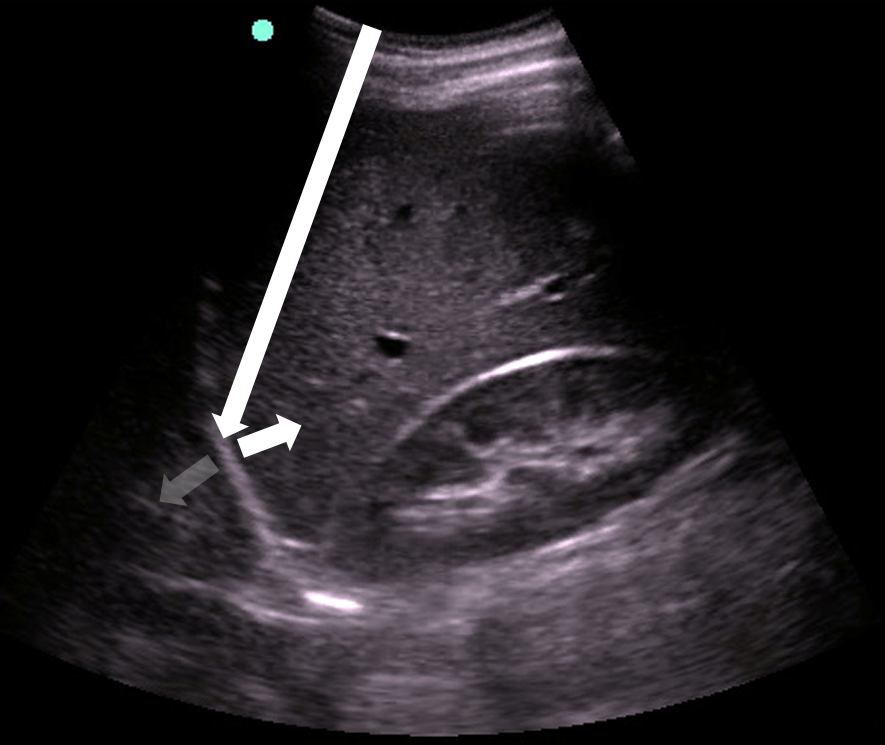 Image 15 - Mirror image artifact.png