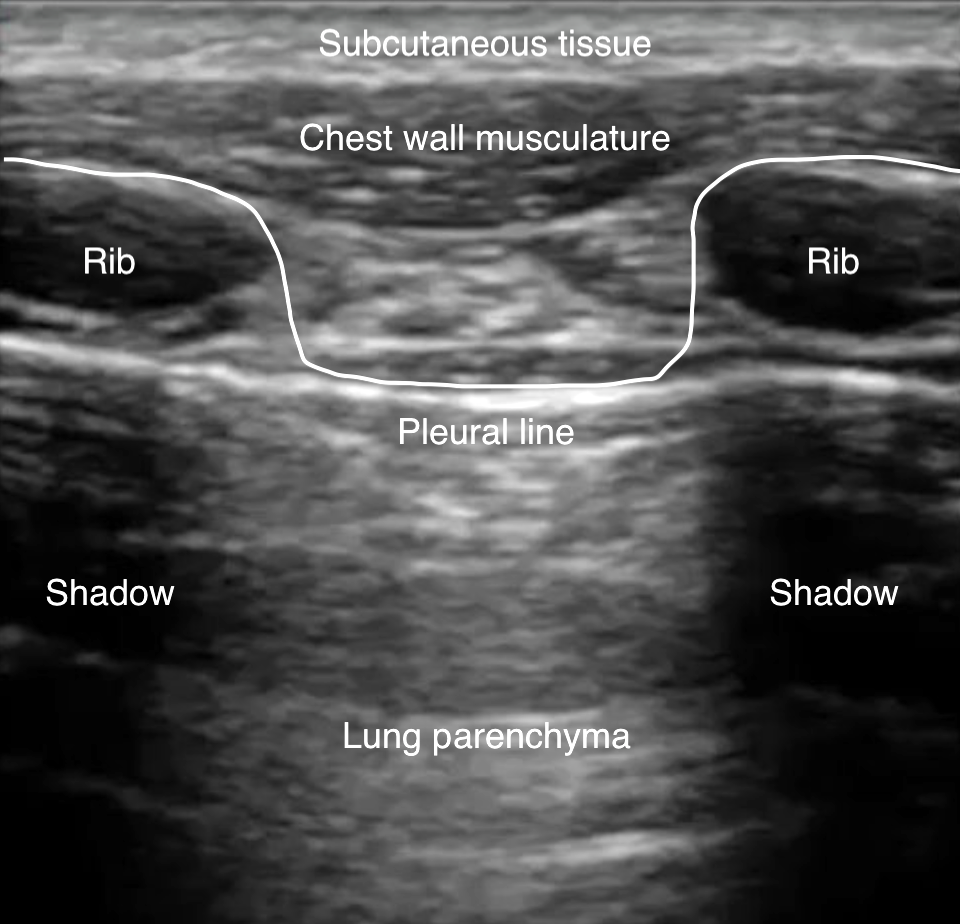 Image 3 - Bat sign.png