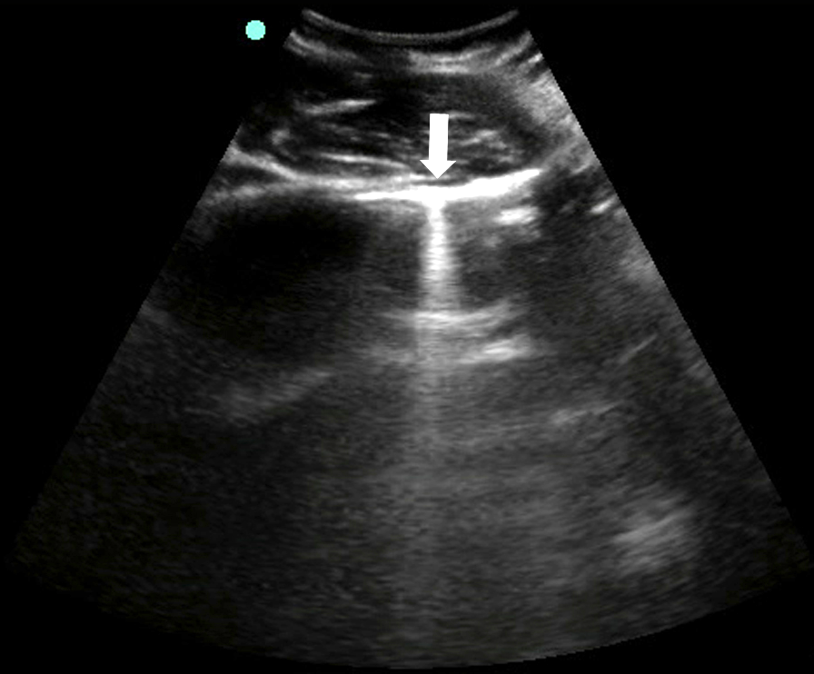 Image 7 - Z-line.png