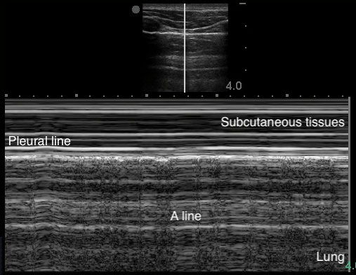 Image 8 - Seashore sign.png