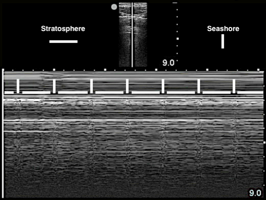 Image 9- Lung pulse in M-mode.png