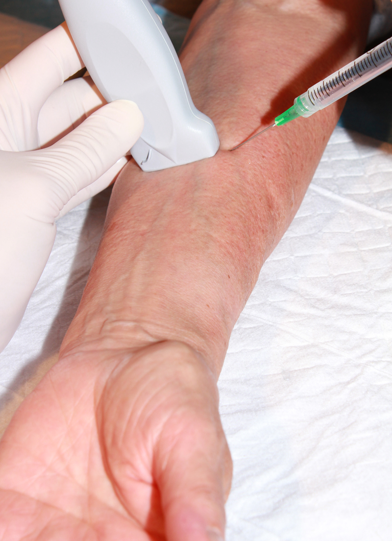 Figure 2 - median hands at forearm.jpg