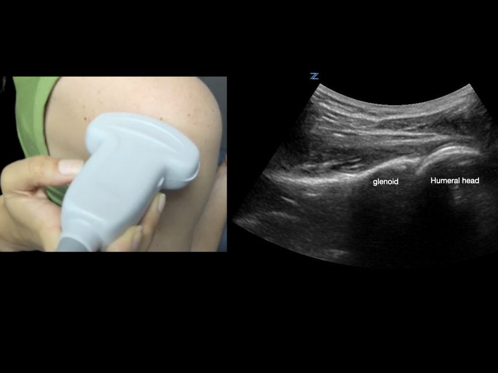 MSK-Figure 4 joint.001.jpeg