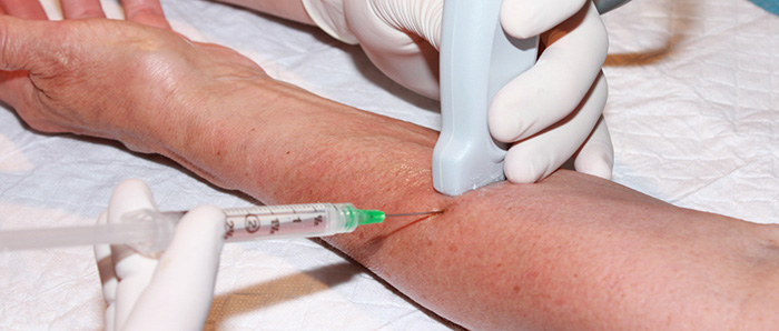 Figure 2.  Hand placement for radial nerve block.jpg