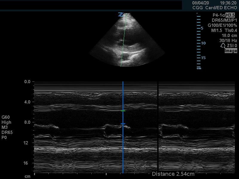 Figure 6 - high epss.jpg