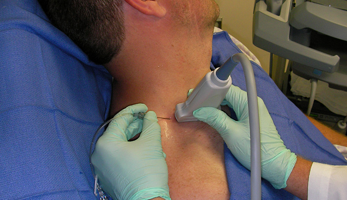 Figure 1. In-plane needle placement.jpg