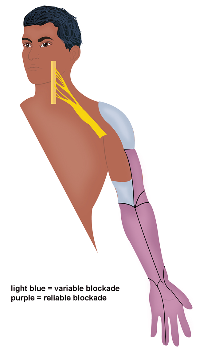 Illustration 1. Supraclavicular fossa.jpg