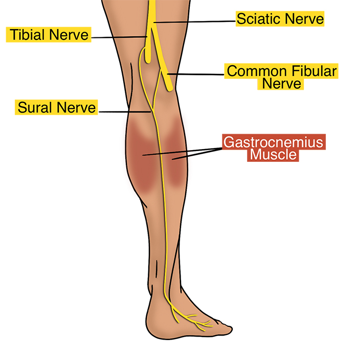 Illustration 2.  Sural Nerve Course.jpg