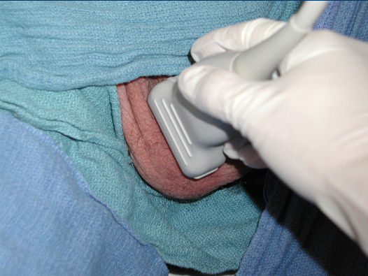 Figure 1_Patient Positioning.jpg