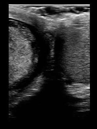 Figure 2_Buddy View Testicles.jpg