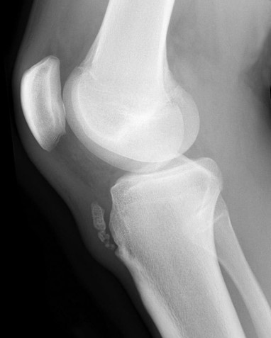 Dec22-Knee3.jpg