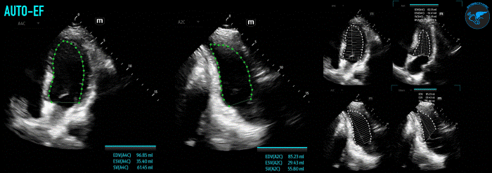 LVSF_Figure 6_AutoEF v1.gif