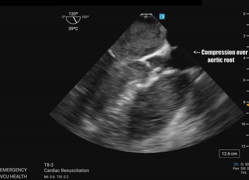 Stay'nAlive ME-LAX figure 3.gif
