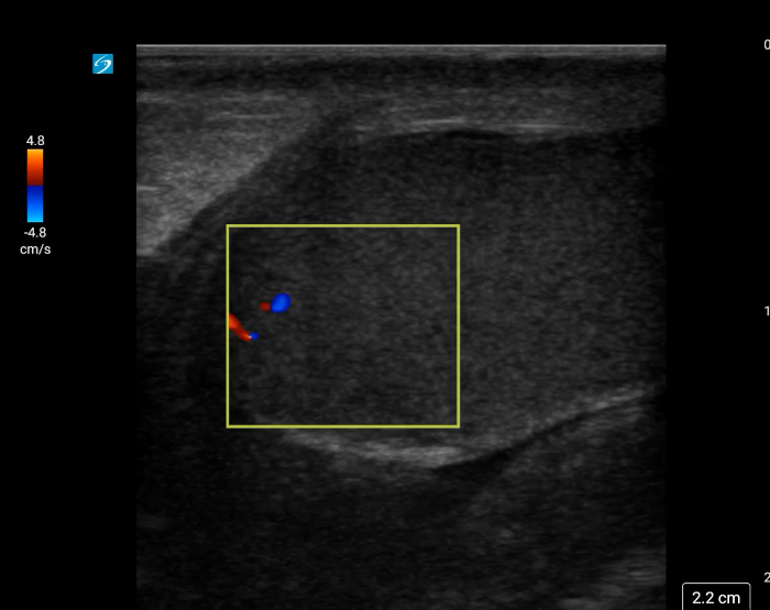 Torsion - image 3_crop.png