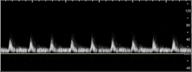 Torsion - image 6.png