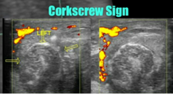 Torsion - image 8.png