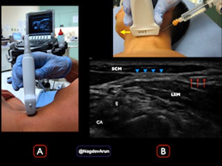 contralateral side.jpg